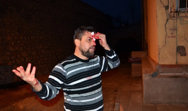 Zonguldak'ta Iraklının Kafasında şişe Kırdılar